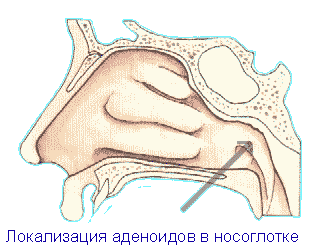 Капли в нос при аденоидах у детей